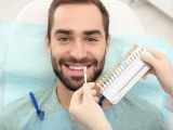 Causes Stains on Teeth