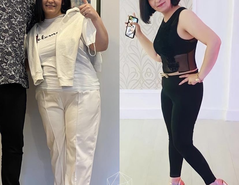 The Turkish Secret to Affordable Weight Loss Surgery